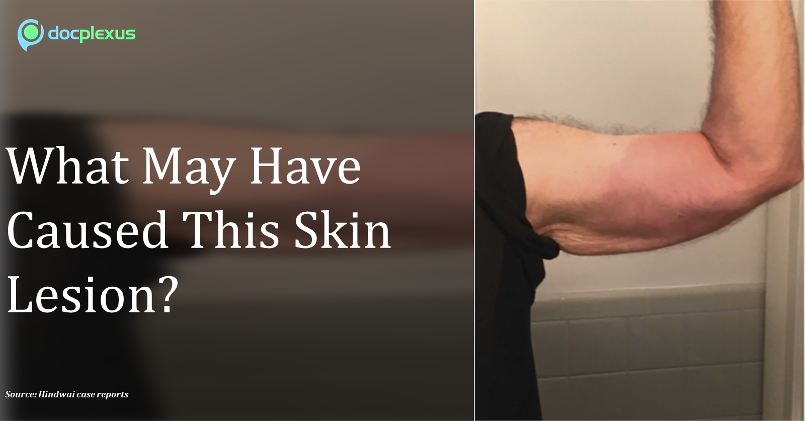 What Caused Skin Lesions in This Elderly Patient?