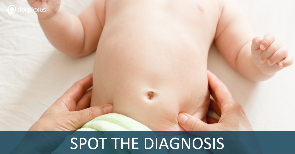 A Child with a Rare Abdominal Mass