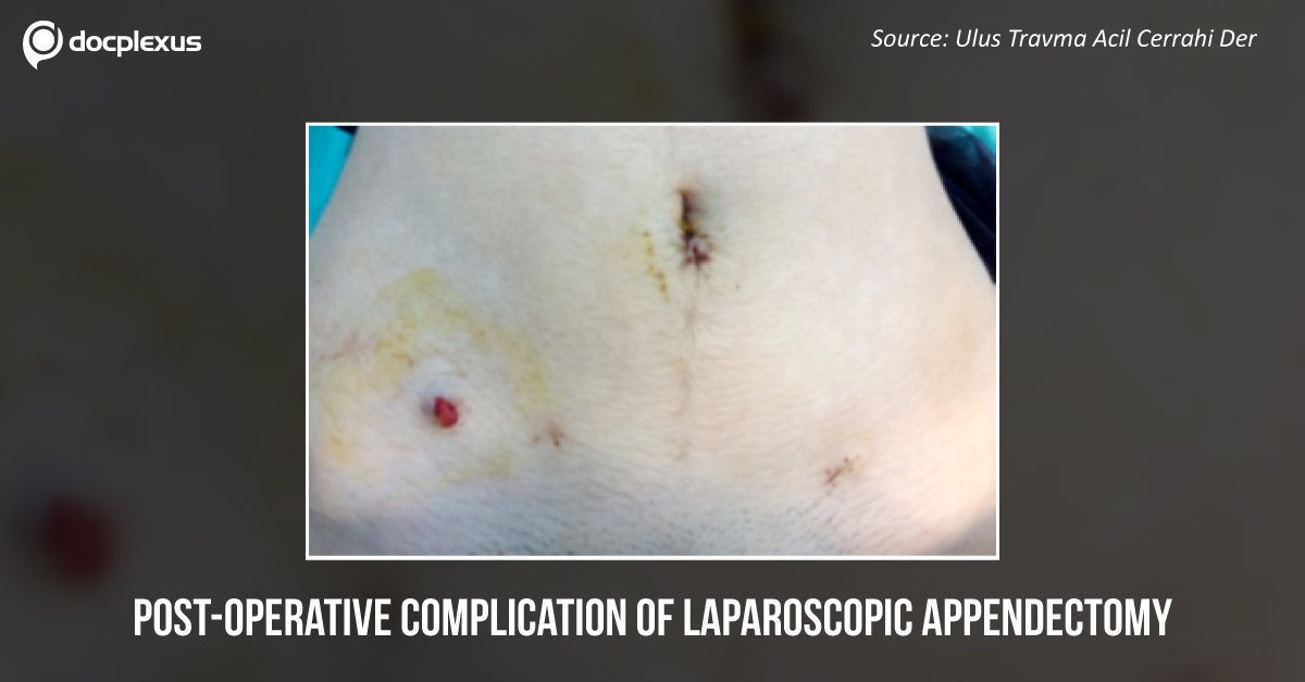 Which Condition is This Young Lady Suffering from?