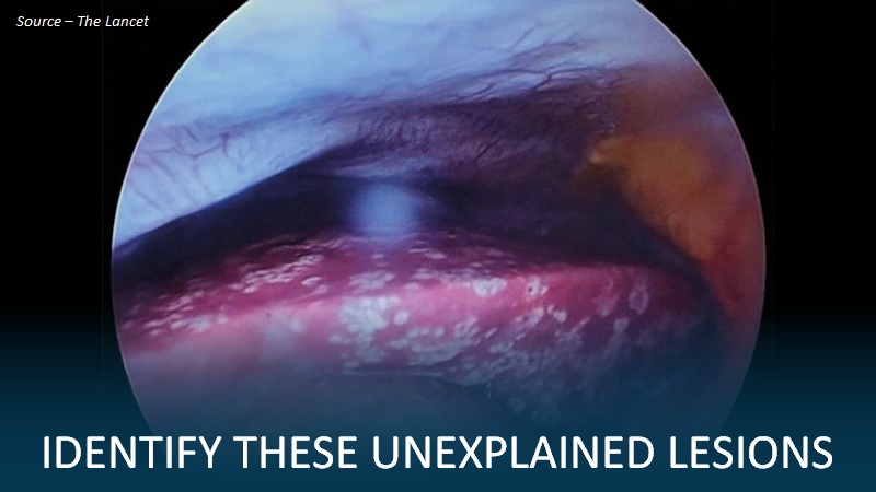 A Young Woman with Unexplained Lesions on the Liver