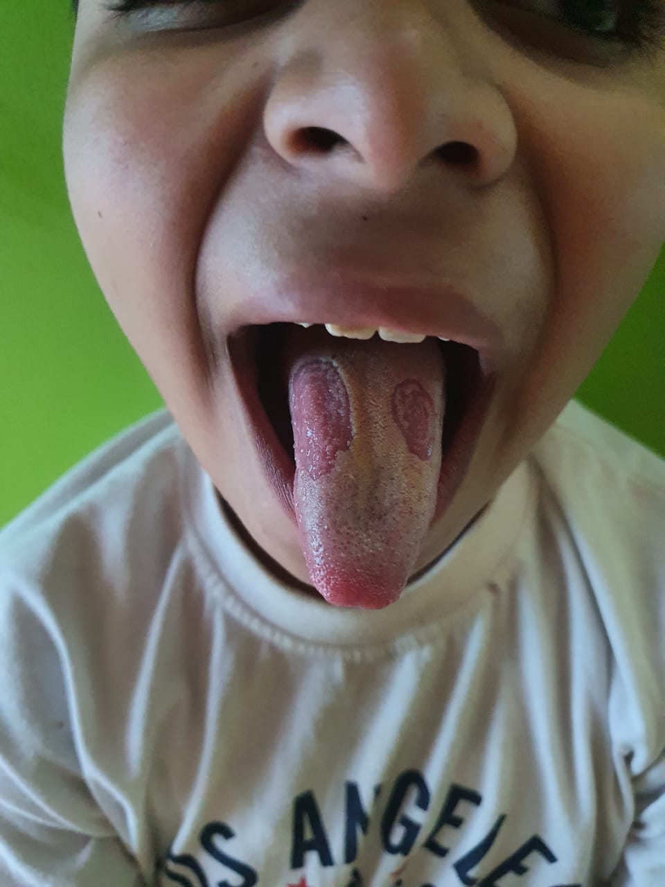 Identify This Condition