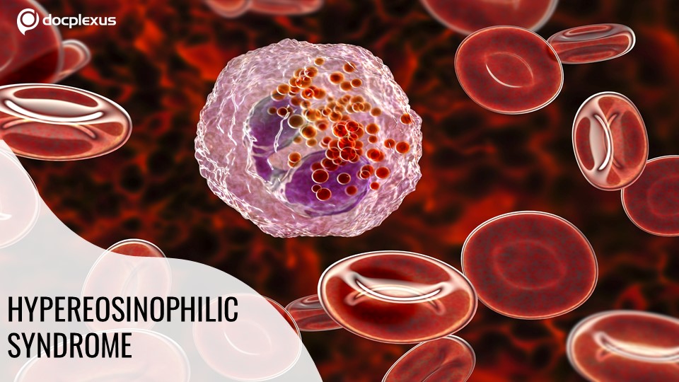 Guess the Medication for Hypereosinophilic Syndrome!