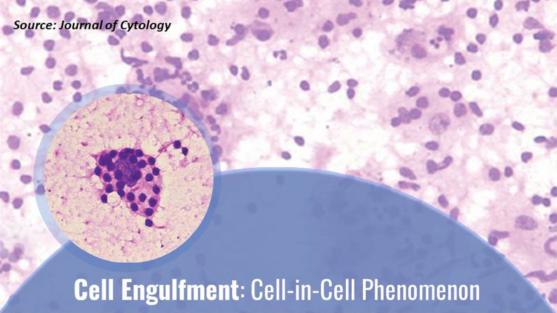 What is the Given Cytopathological Section Indicating?