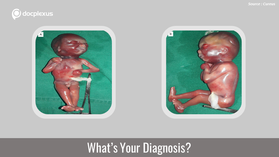 Can You Diagnose This Rare Case of Recurrent Pregnancy Loss?