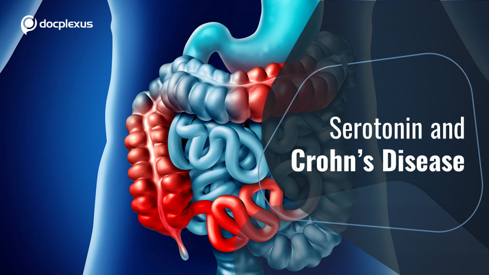Role of Serotonin in Crohn’s Disease
