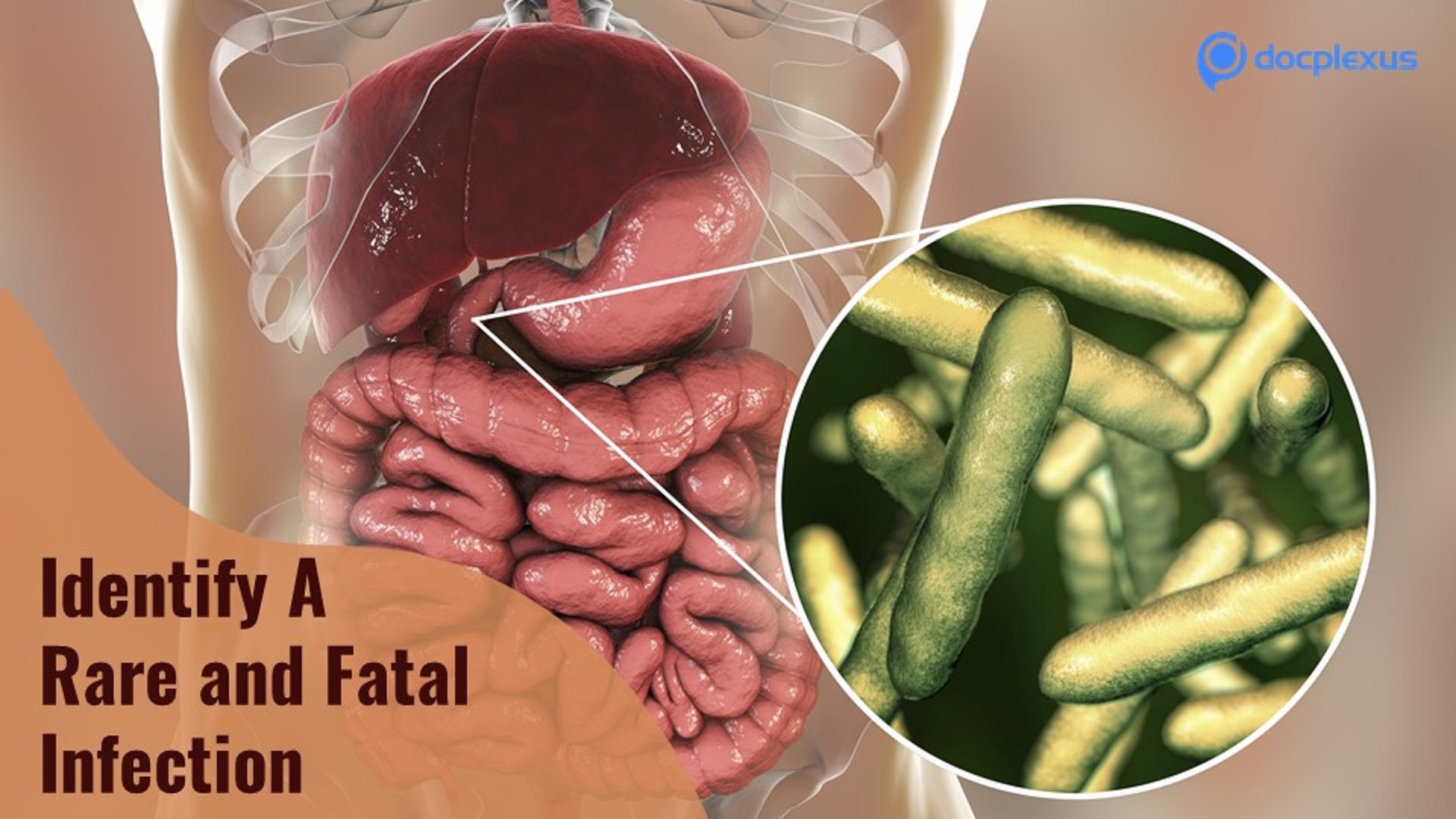 Identify This Rare and Fatal Infection