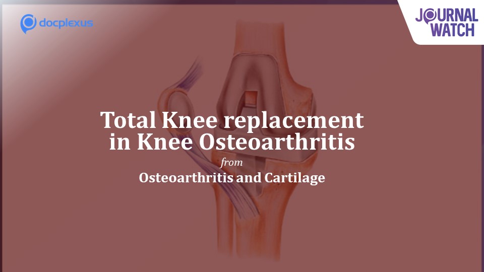 Total Knee Replacement and Non-Surgical Treatment of Knee Osteoarthritis