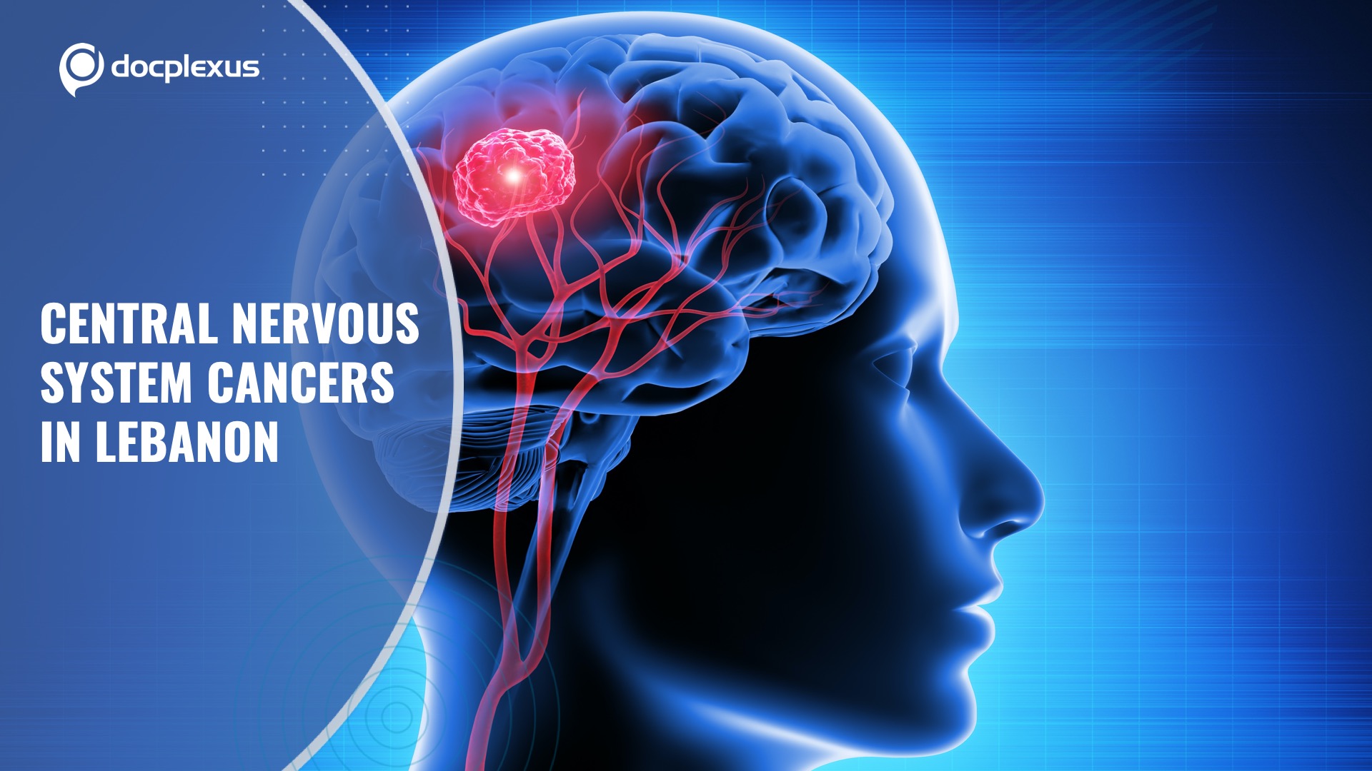 Prevalence of CNS Cancers in Lebanon