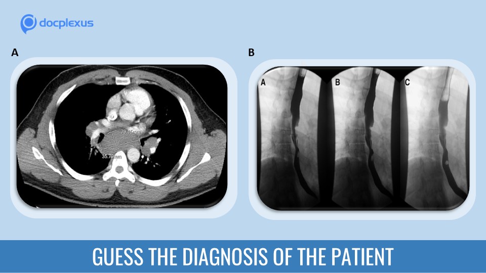 Diagnose This Patient’s Condition