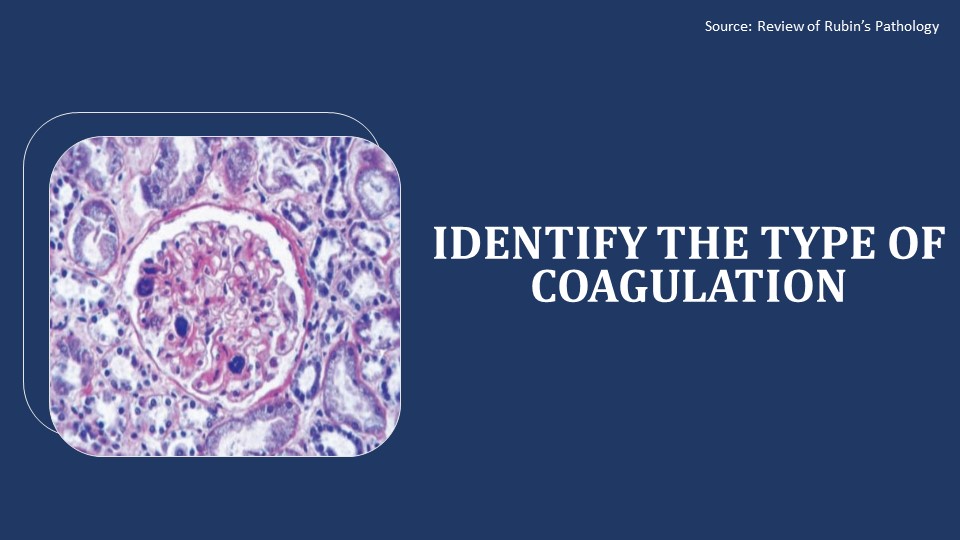Renal Failure in the Patient: Identify the Cause