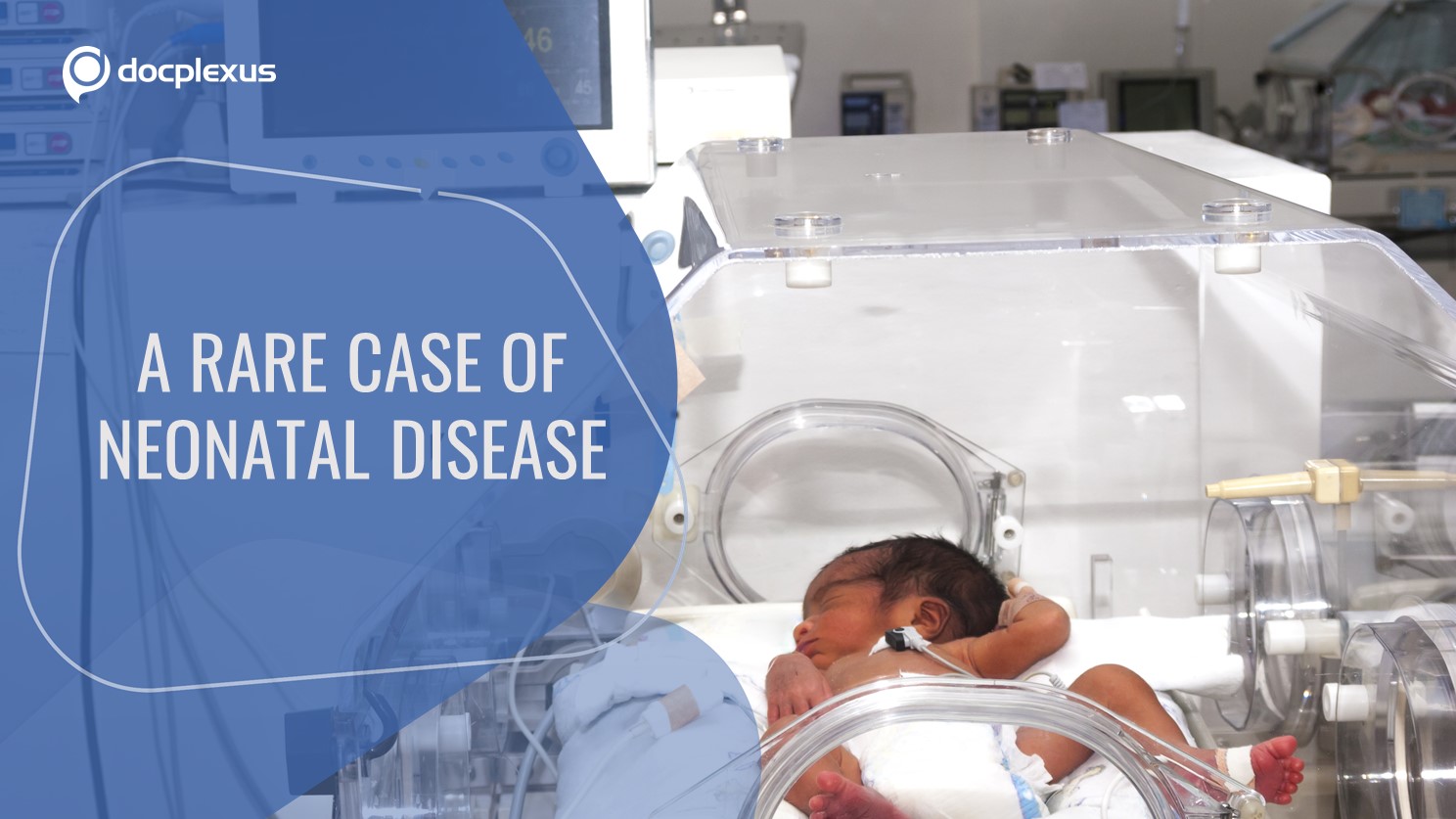 An Uncommon Disease Associated with the EGFR Mutation