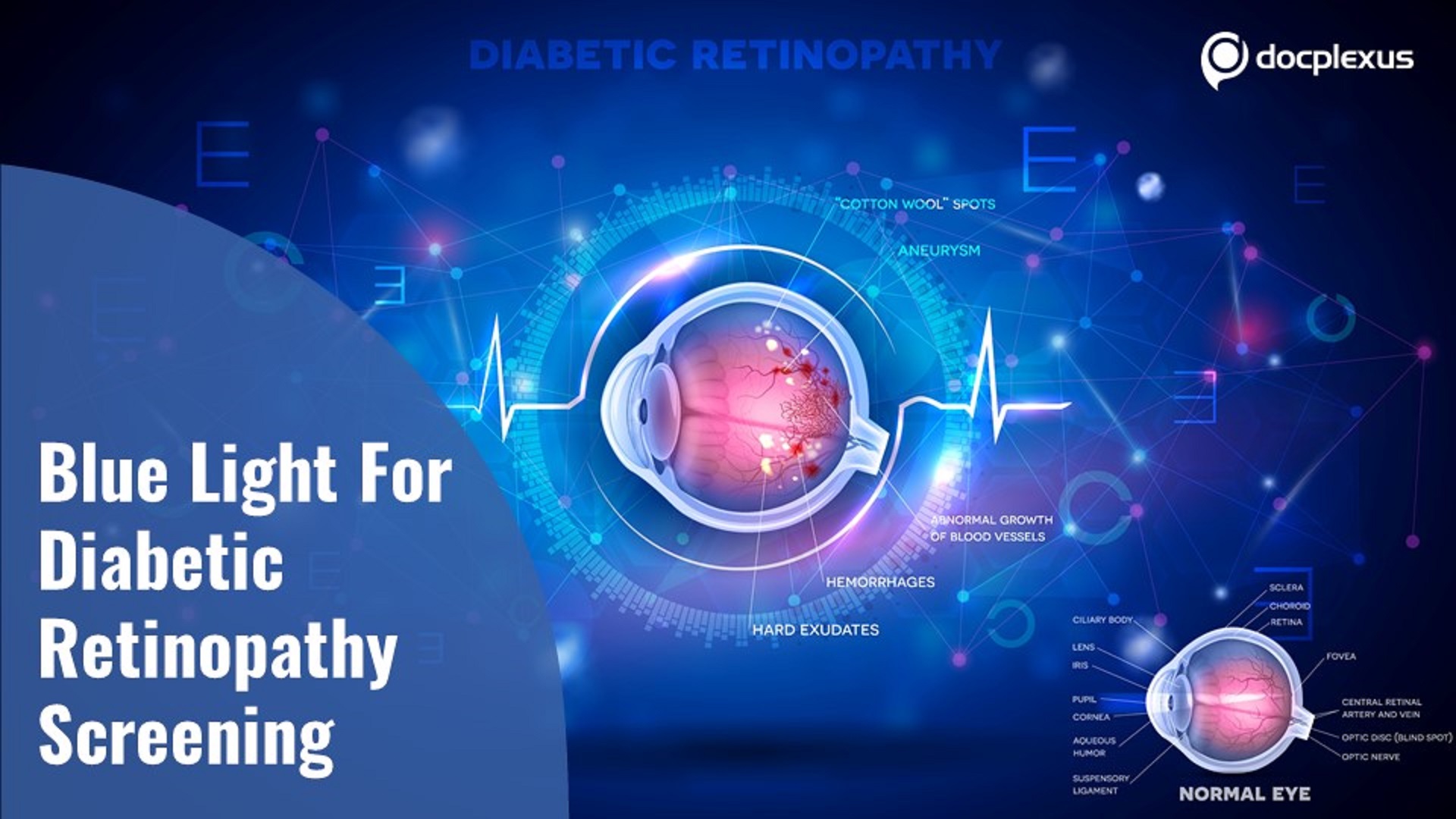 Blue Light for Diabetic Retinopathy Screening