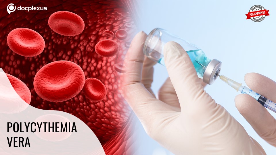 USFDA Approves Treatment for Polycythemia Vera