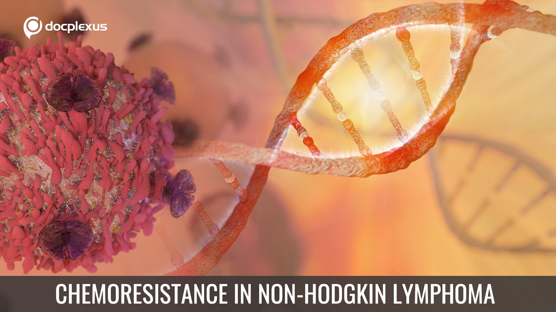 Mutation in DDX3X Induces Chemoresistance in Non-Hodgkin Lymphoma