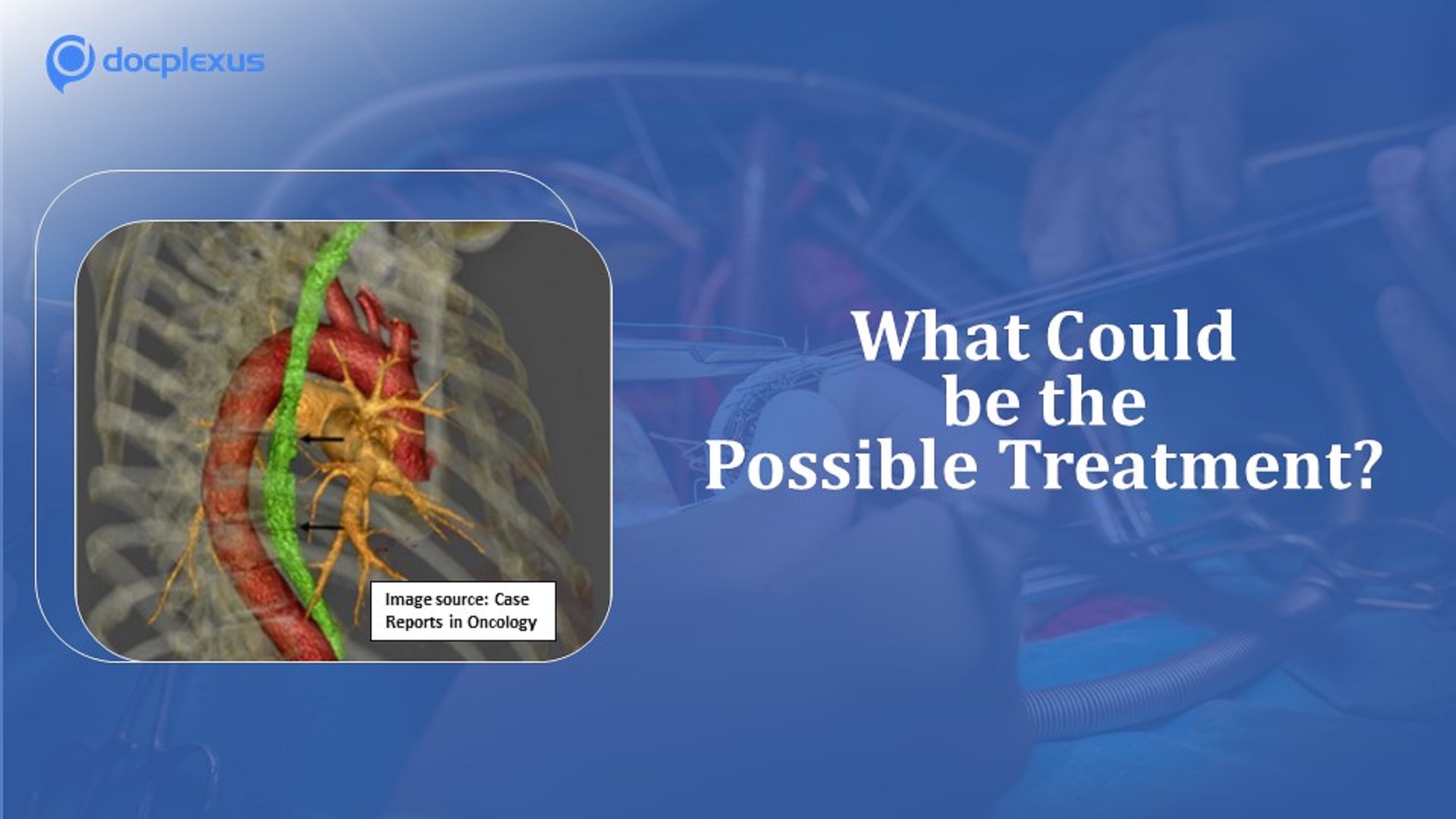 Case of a Man with Mitral Valve Pathology and Esophageal Cancer
