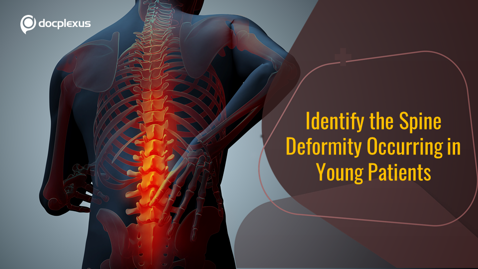 Guess This Complication of Adolescent Idiopathic Scoliosis