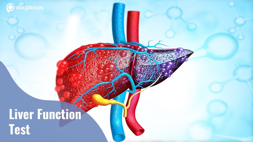 Liver Function Test Can Fail to Diagnose Alcoholic Cirrhosis