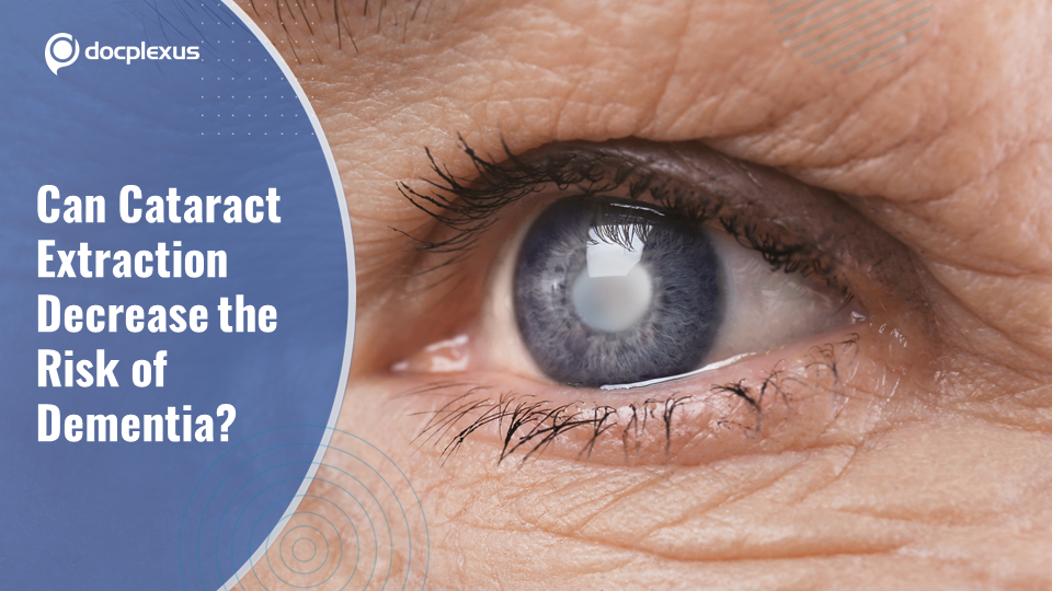 Cataract Extraction to Prevent Dementia
