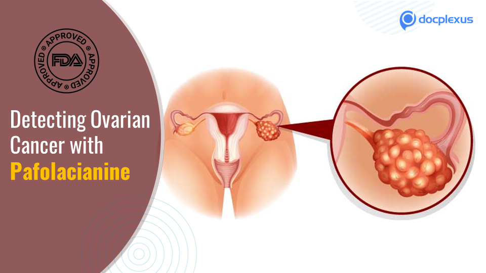 USFDA Approves Pafolacianine for Ovarian Cancer Detection