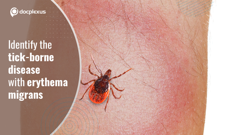 Identify the Tick-borne Disease with  Erythema Migrans
