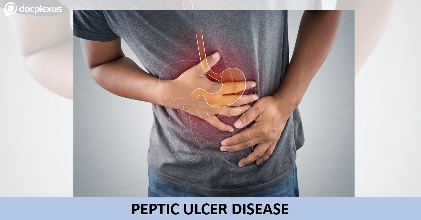 Answer This Question on Peptic Ulcer Disease