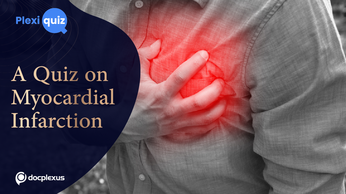 Ace This Quiz on Myocardial Infarction