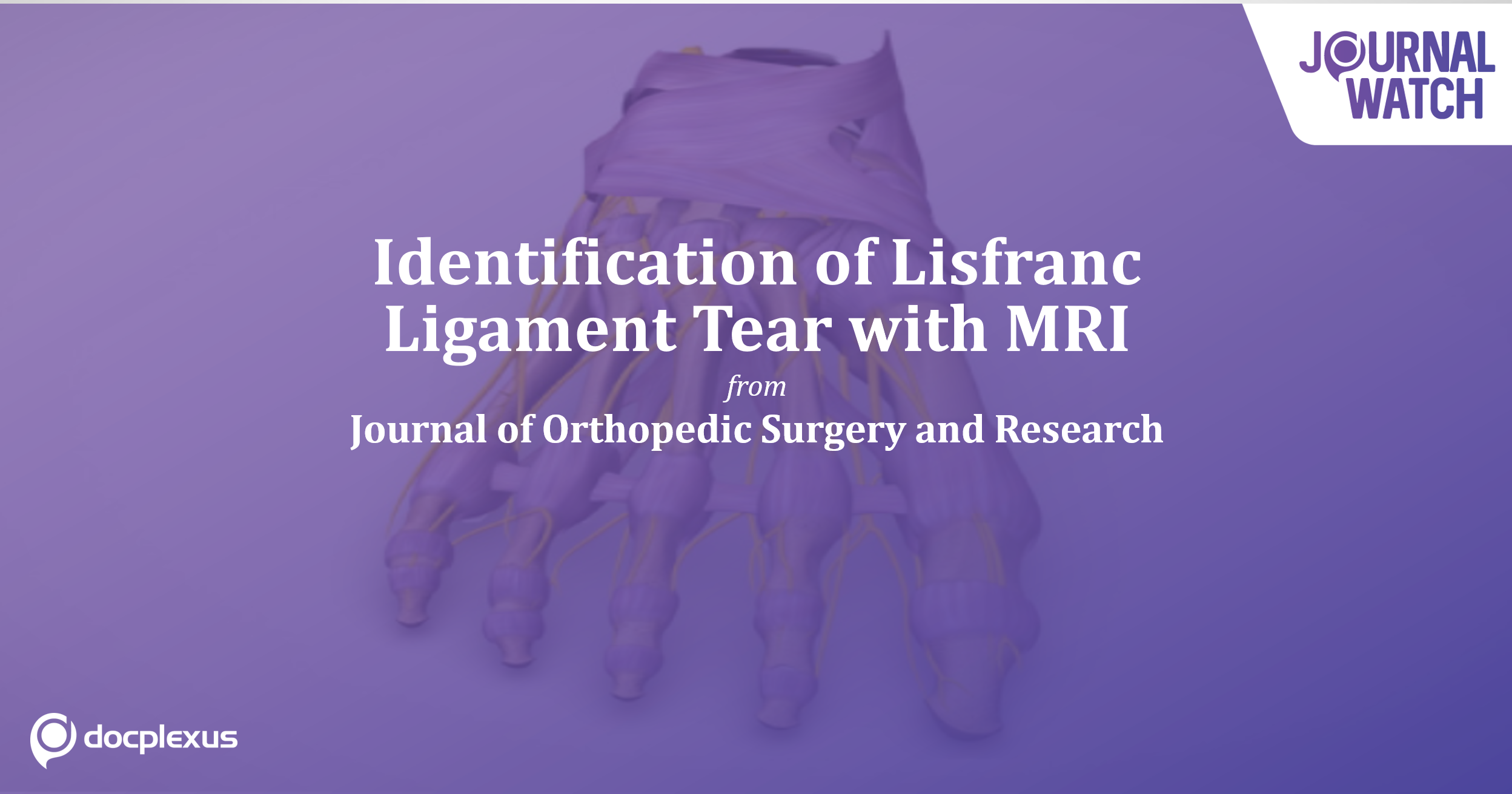 MRI Usage In Diagnosing Lisfranc Ligament Tear