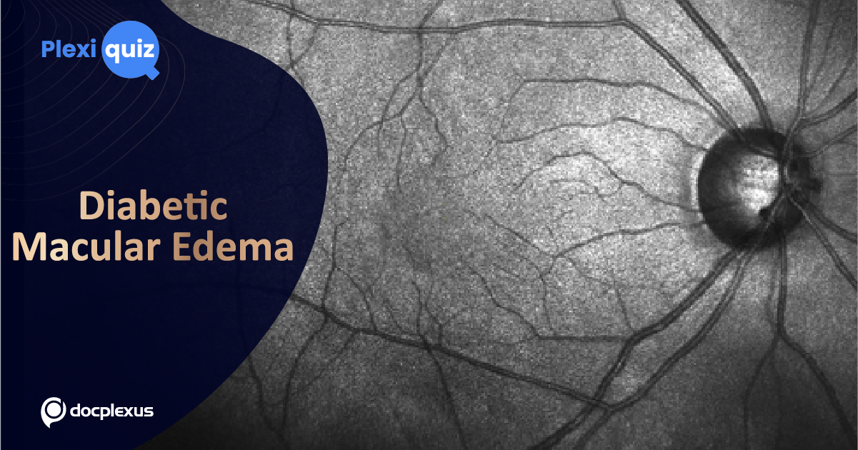 How Well Do You Know Diabetic Macular Edema?