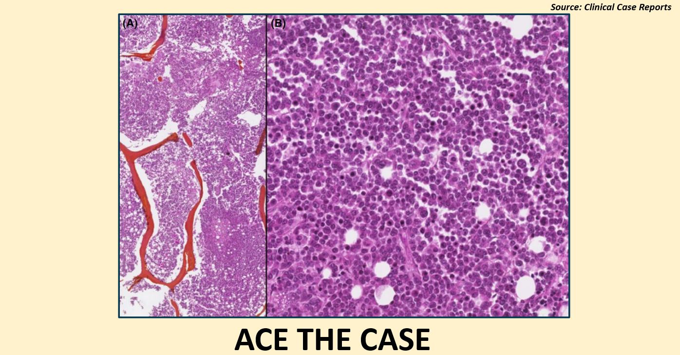 A Case of Gastrointestinal Bleeding – What’s Your Diagnosis ?