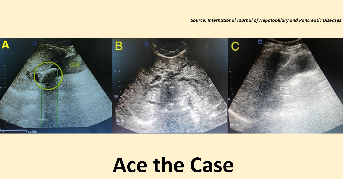 A Patient with Severe Abdominal Pain: What’s Your Diagnosis?