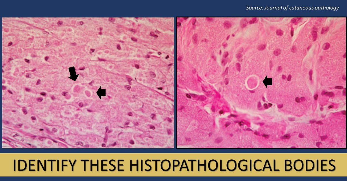 Can You Identify These Histopathological Bodies?