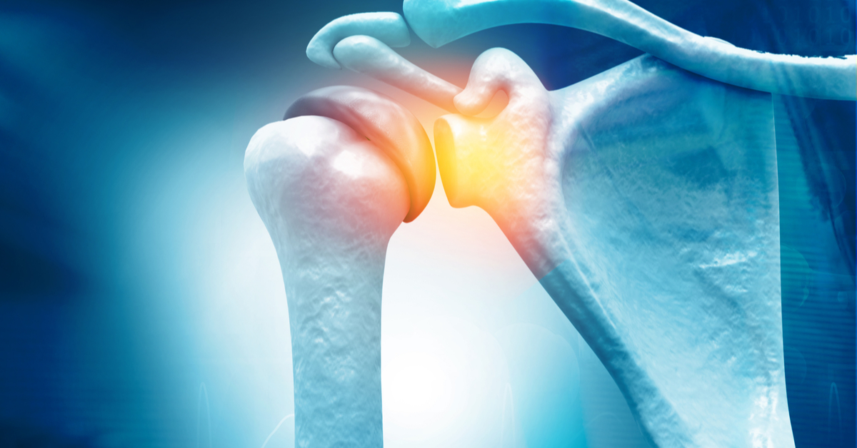 Persistent Shoulder Pain and Stiffness in an Elderly Man