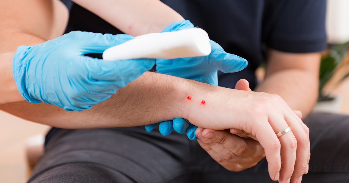 Management of Patients with Snakebite