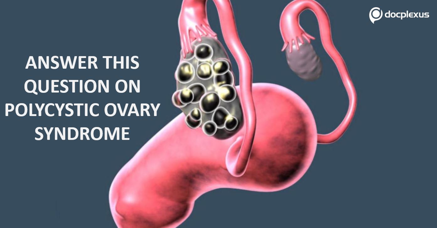 Can You Identify the Incorrect Statement on PCOS?