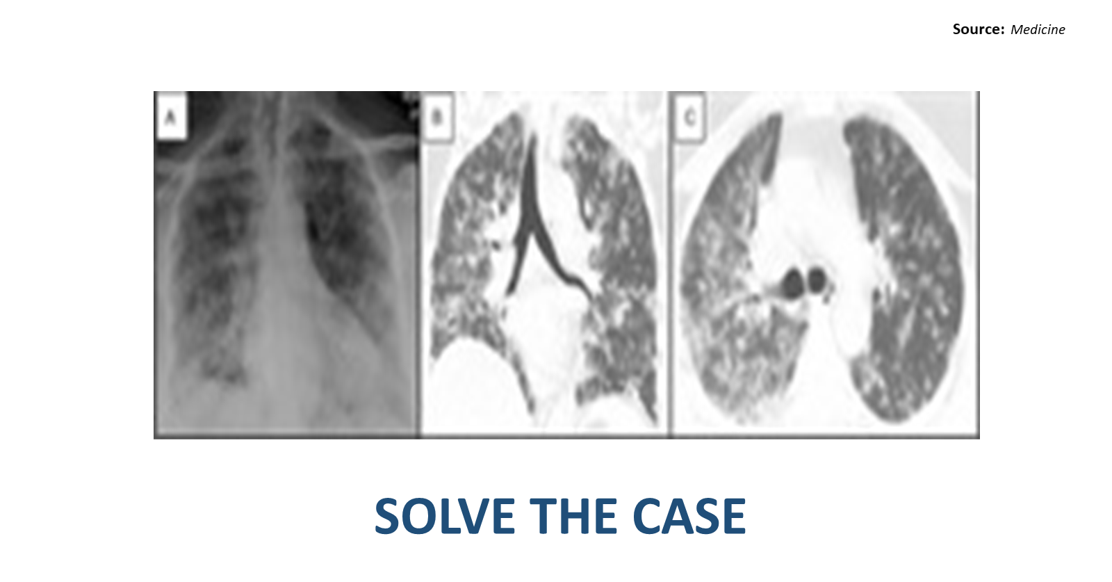 An Old Woman with Generalized Petechial Rash and Dyspnea