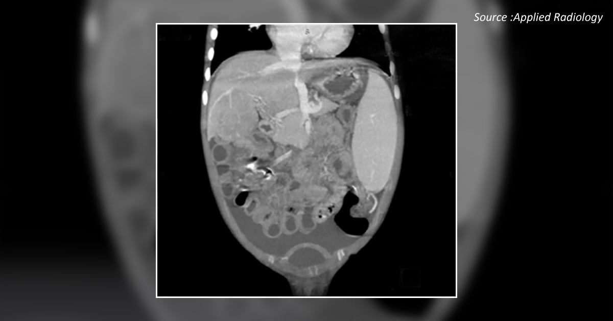 Diagnose This Case Based on the Radiological Findings
