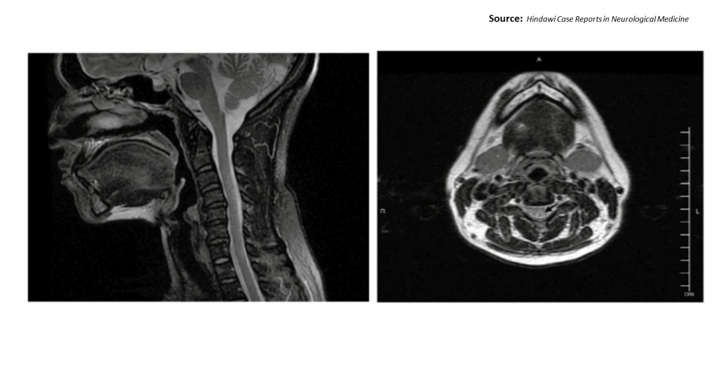 What is Your Diagnosis for This Patient?