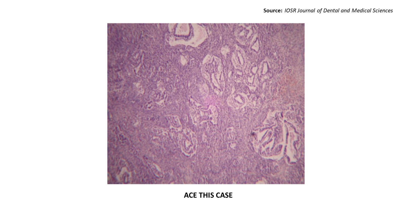 Man with a Large Anterior Mediastinal Mass