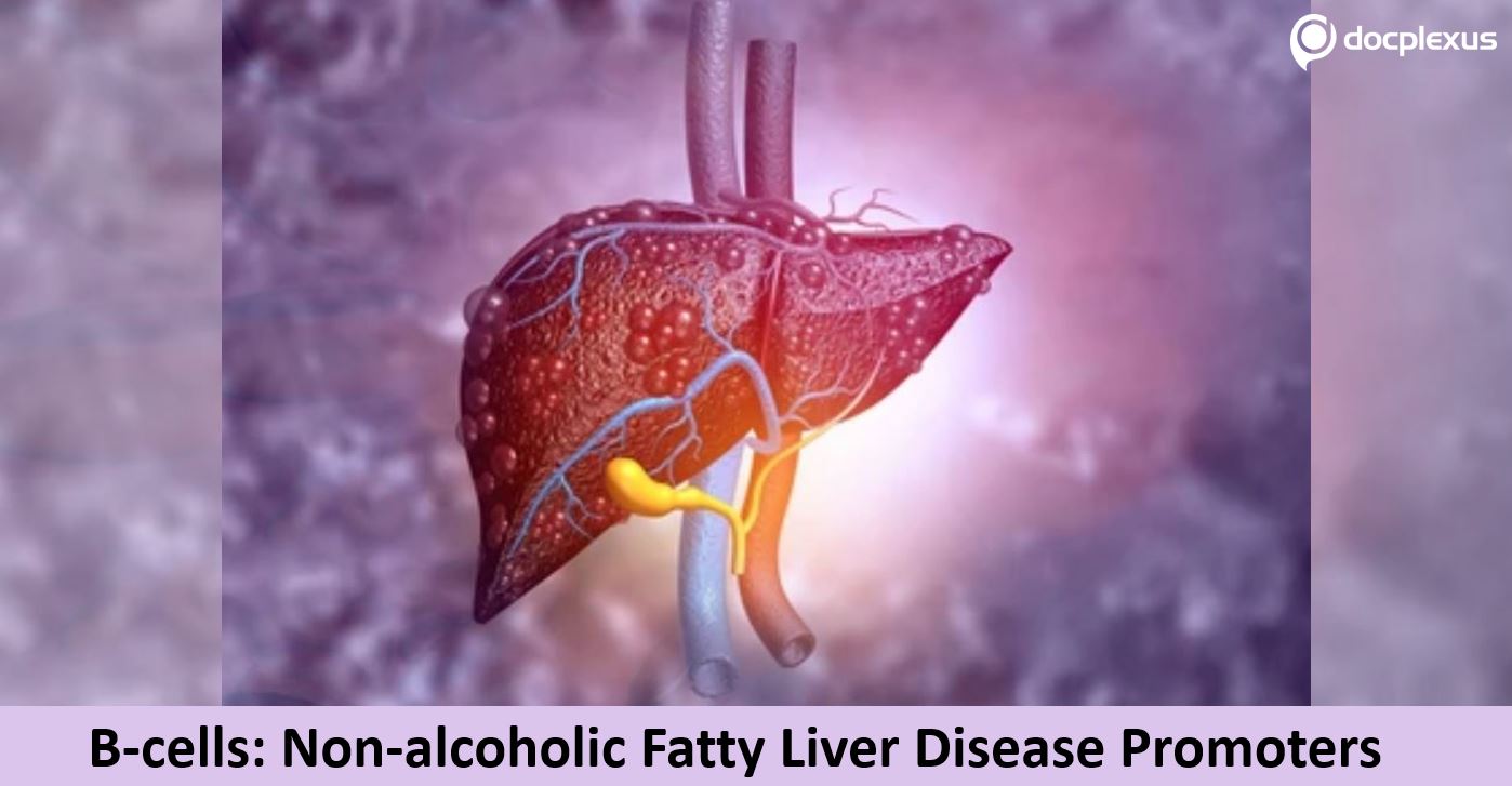 Role of B-cells in the Development of Non-alcoholic Fatty Liver Disease