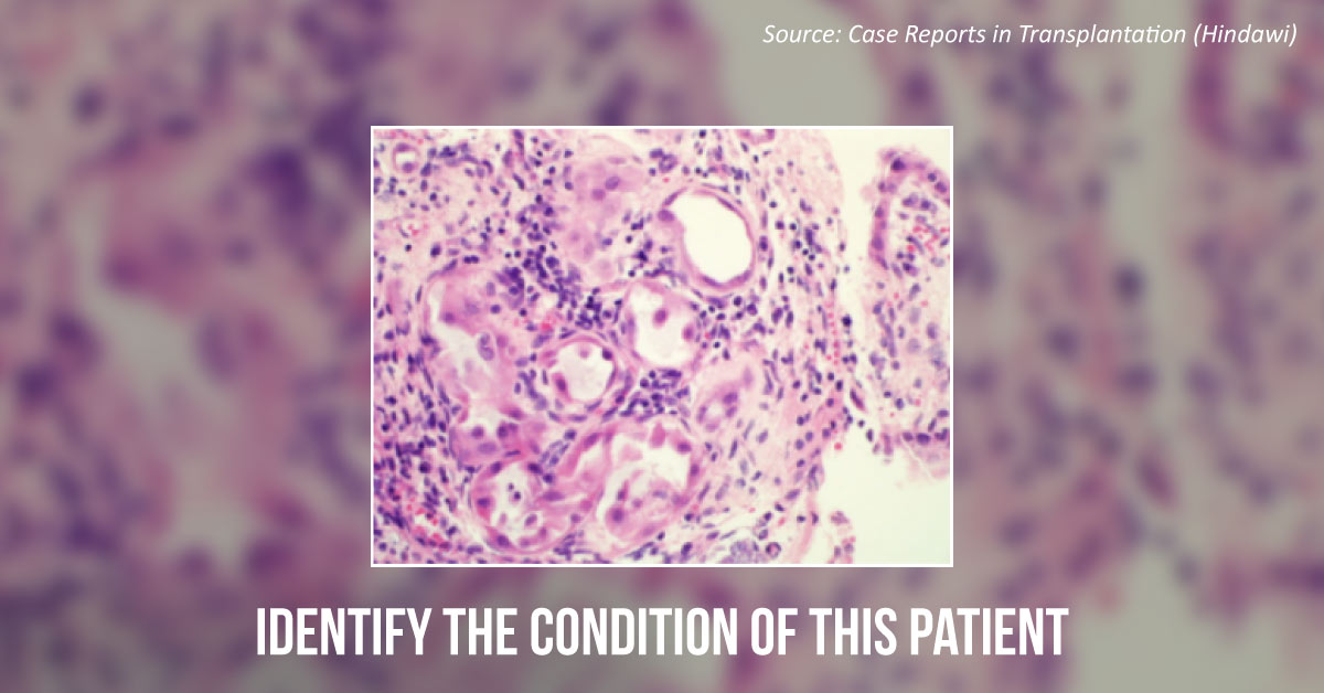 A Case of Uncommon Urinary Bladder Lesions