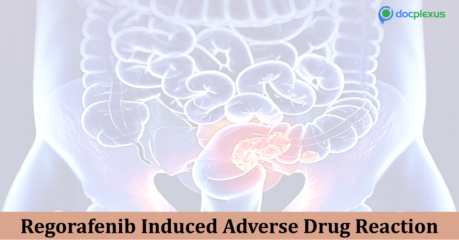 Suggest the Appropriate Management for the Adverse Drug Event in this Male