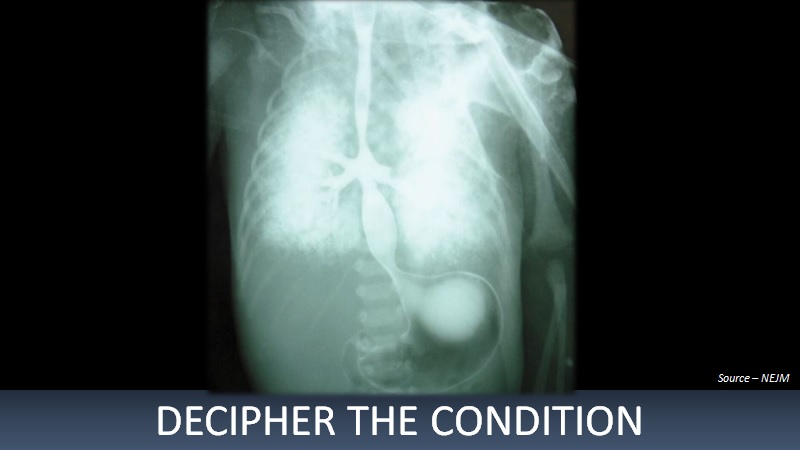 What Does This Esophagram Indicate?
