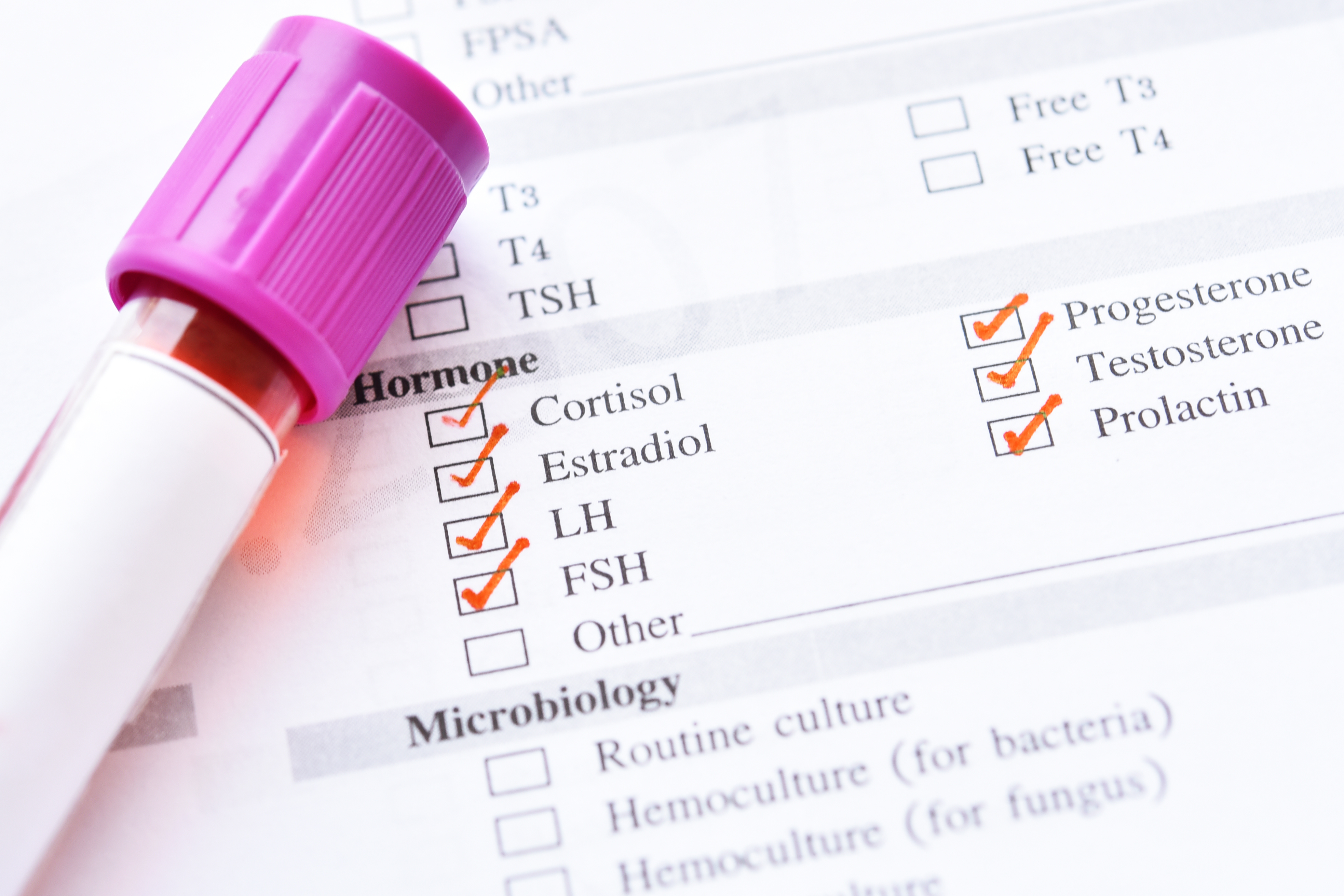 Answer This Question on HIV and Hormones