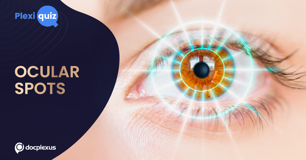 Quiz on Ocular Spots