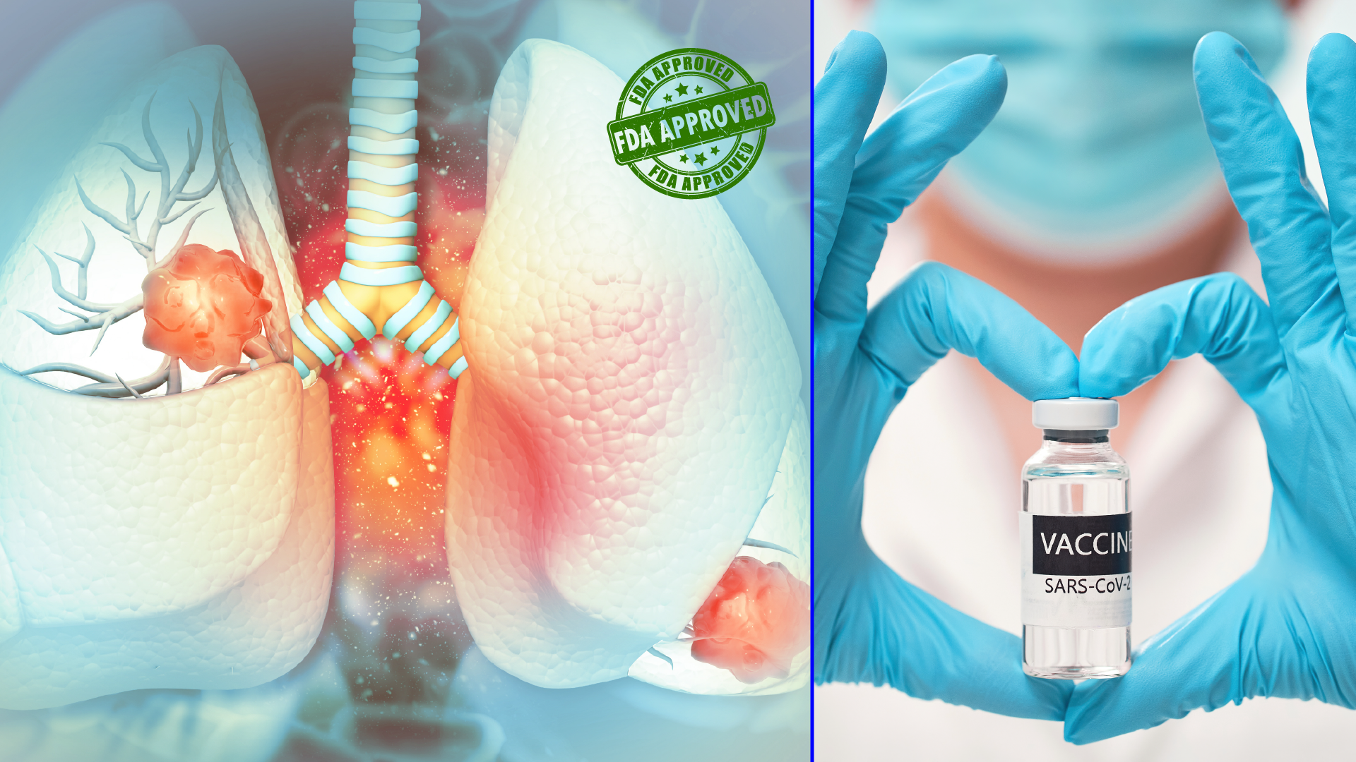 USFDA Approves First Targeted Drug for Non-small Cell Lung Cancer