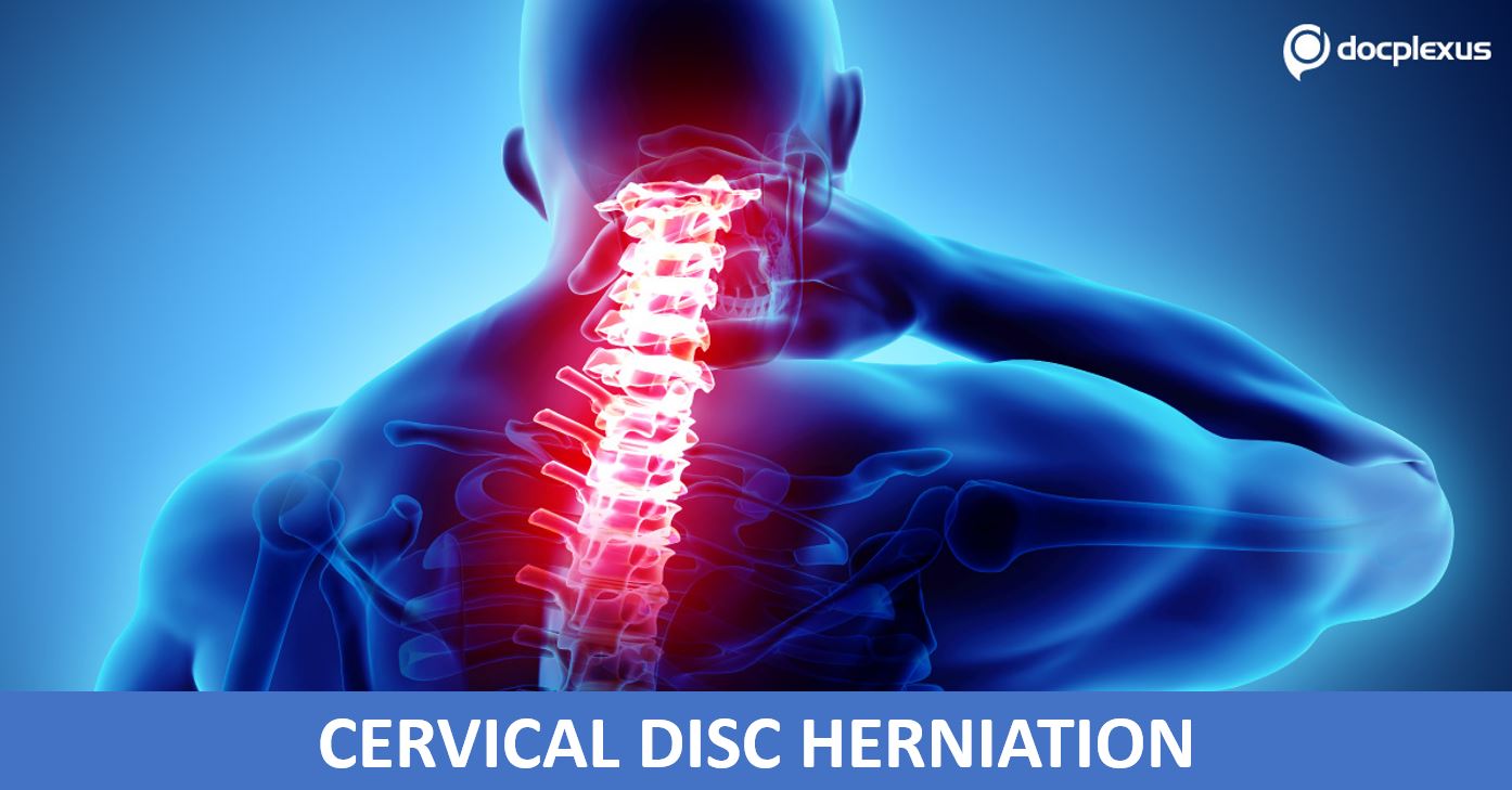 Which is the Gold Standard Treatment for Cervical Disc Herniation?