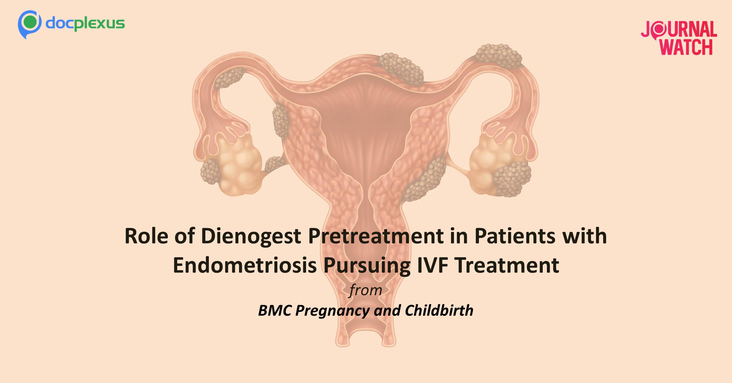 Dienogest Pretreatment for Endometriosis Suppression in Patients Pursuing IVF Treatment