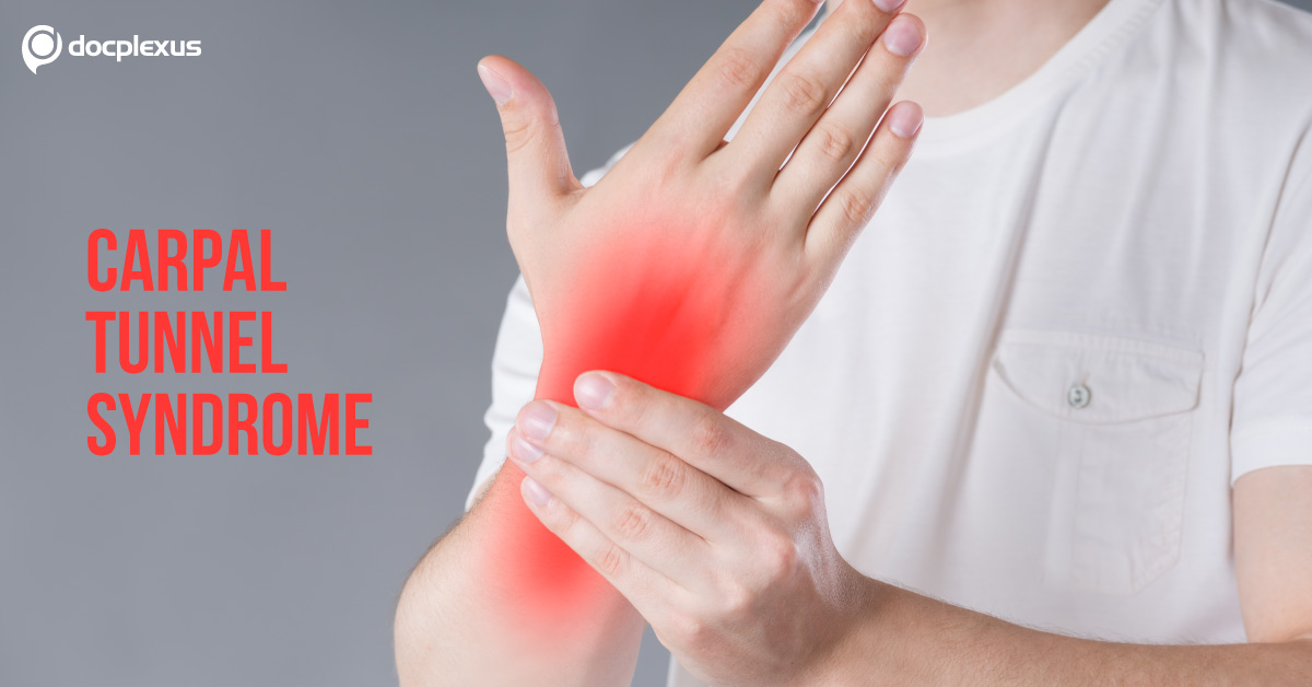 Quiz on Carpal Tunnel Syndrome