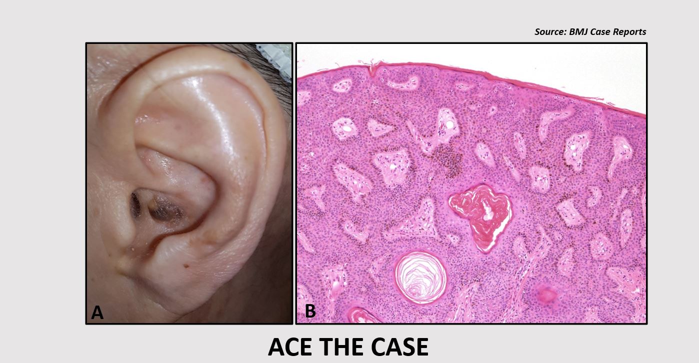 Identify the Reason Behind the Lesion