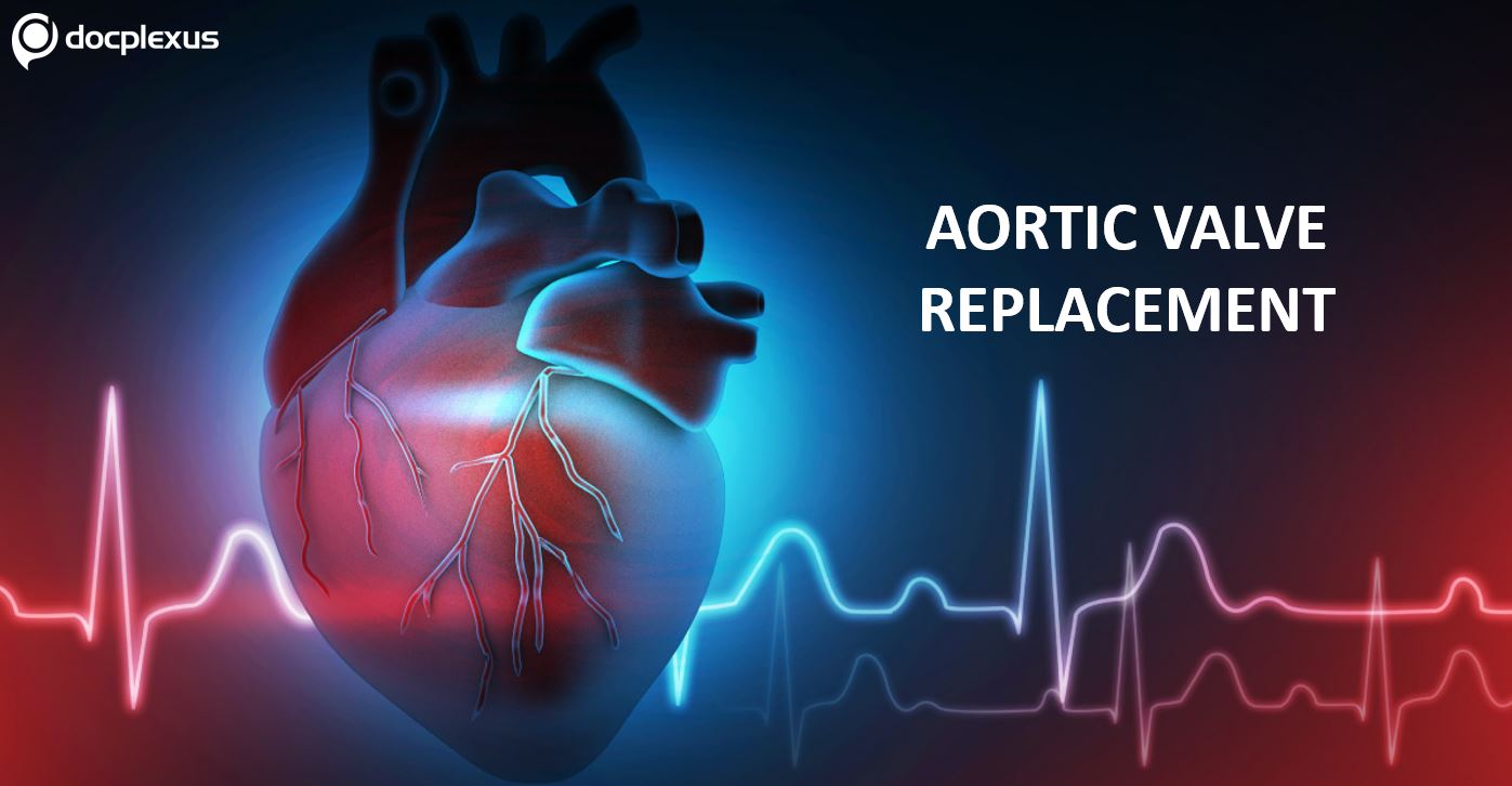 Can You Answer This Question on Aortic Valve Replacement?